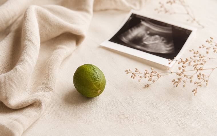 Your baby at 12 weeks, about the size of a lime
